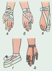 Бинтовые повязки на верхнюю и нижнюю конеч-ности: а - на кисть и лучезапястный сустав; б - на II палец кисти; в - на I палец стопы; г - на всю стопу; д - сетчатая повязка на пальцы кисти.